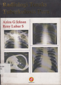 Radiologi Toraks Tuberkulosis Paru